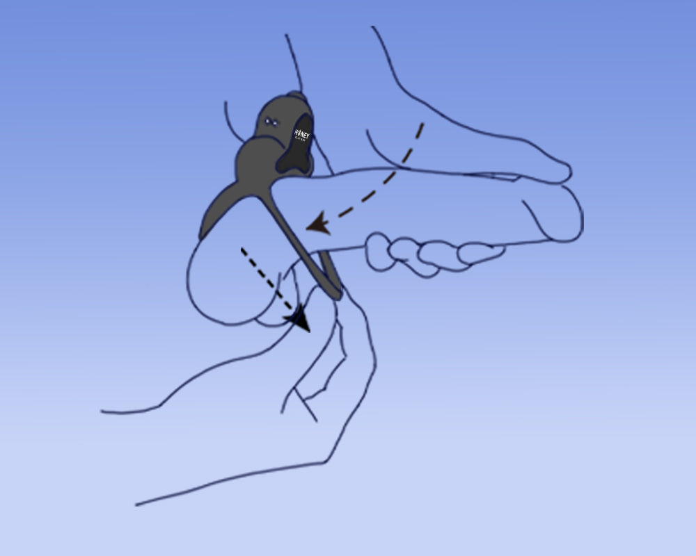 Step 2